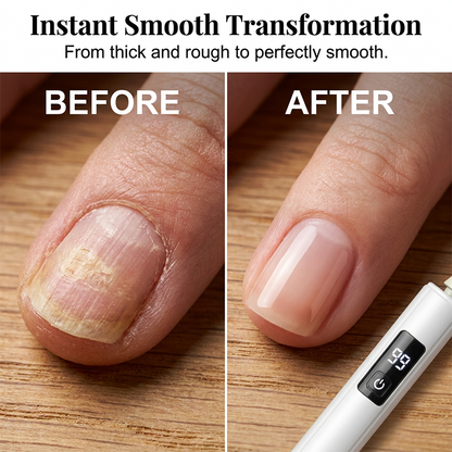 🥳2026 HOT SALE🥳 Professional Electric Nail Polisher – Smooths thick nails